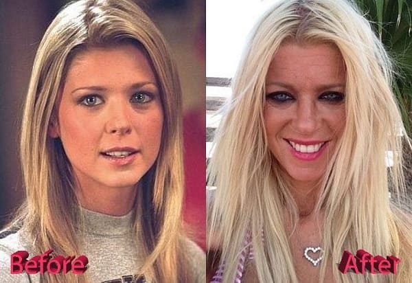 TOP-7 pretty celebrities who made themselves ugly!